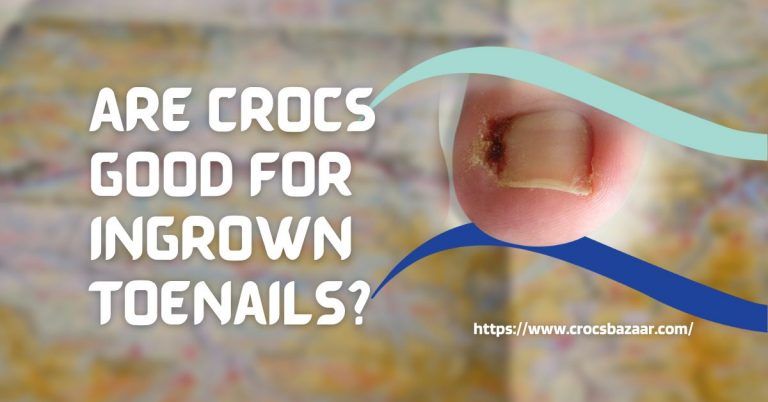 Are Crocs Good for Ingrown Toenails?